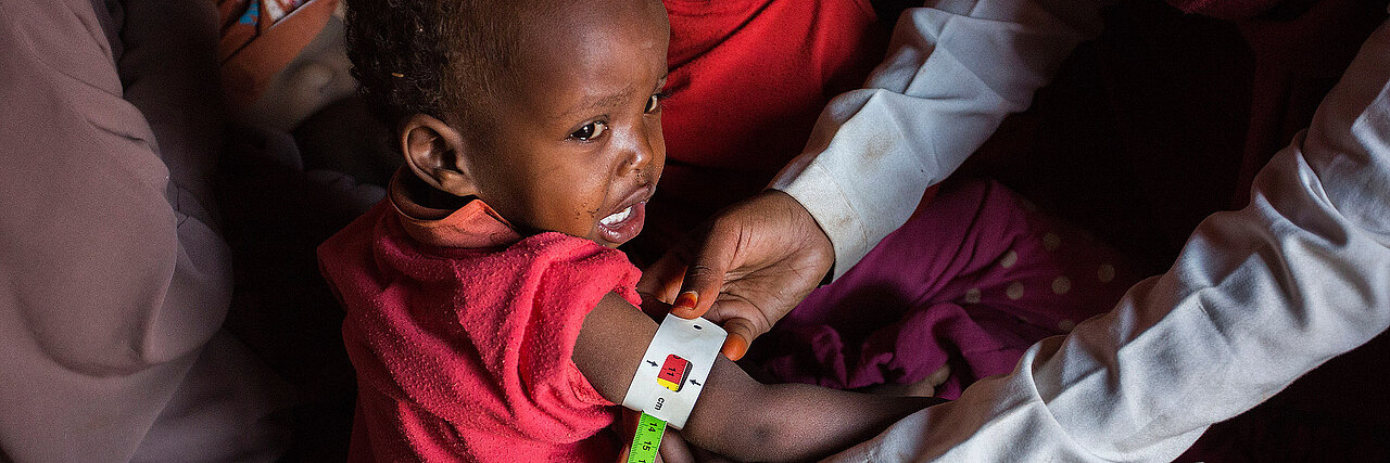 Ein somalisches Kind wird während der Hungersnot untersucht