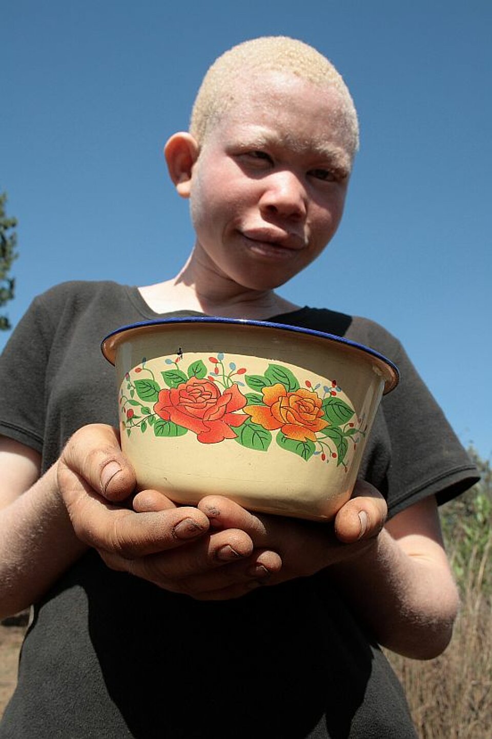 Foto: Ein Albinojunge mit einem bunt bemalten Topf in den Händen.
