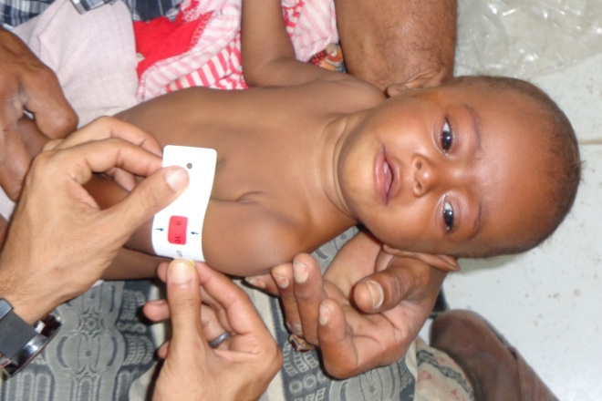 Untersuchung eines Kleinkinds im Jemen