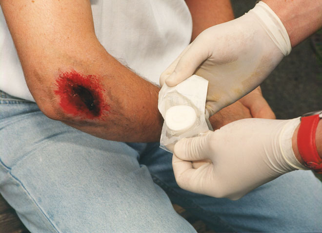 Ellenbogenverband - Erste Hilfe - DRK e.V.